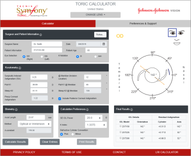 Toric Calculator